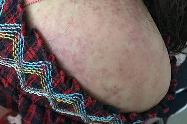 Actor Gene Hackman, Wife Betsy Arakawa Found Dead; Cause Unknown